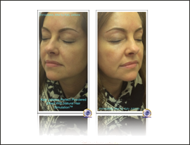 12-Katy Jobbins Permanent Makeup Perfect Powdered Effect With Natural Hair Simulation FI 12-Katy Jobbins Permanent Makeup Perfect Powdered Effect With Natural Hair Simulation FI