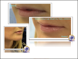 21-Katy Jobbins Permanent Makeup Watercolour Lip Blush FI 21-Katy Jobbins Permanent Makeup Watercolour Lip Blush FI