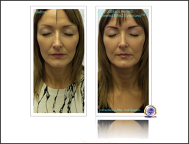 Permanent Makeup 2nd Session Powered Effect Eyebrows